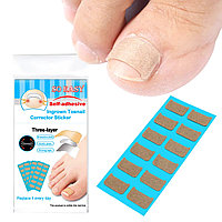 Пластырь корректор для вросшего ногтя So easy
