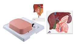 Набор «Желчный пузырь»