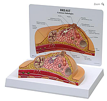 Модель молочной железы в поперечном сечении
