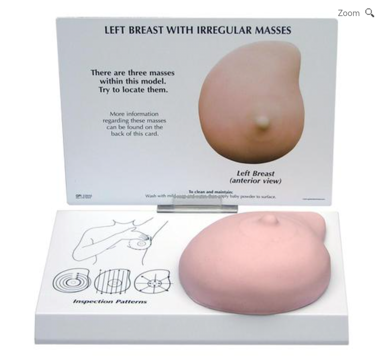 Модель левой молочной железы с новообразованиями, фото 1