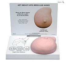 Модель левой молочной железы с новообразованиями