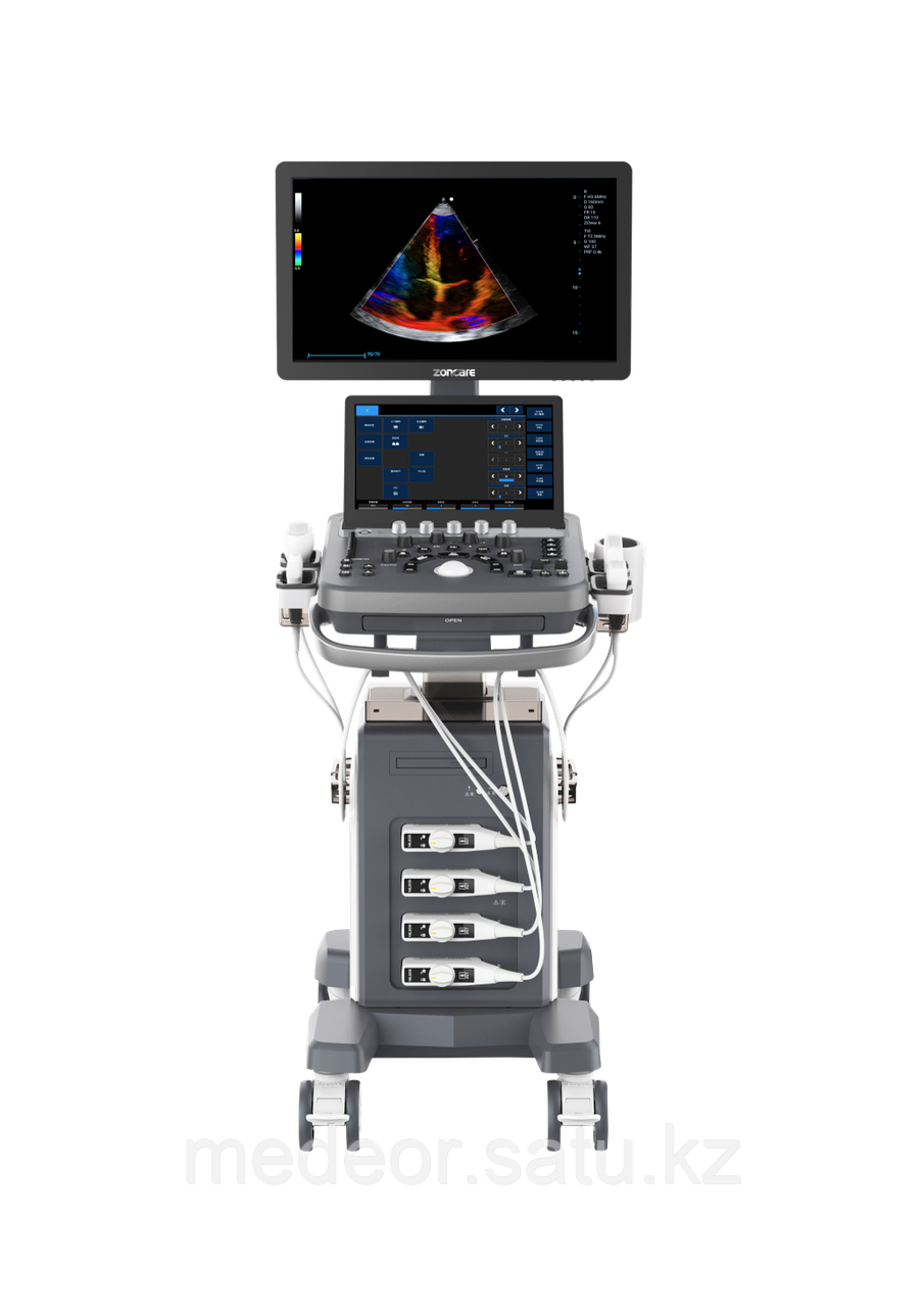УЗИ аппарат Zoncare Viv 60 - фото 1 - id-p124238675