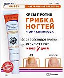 Косметический крем для восстановления ногтей от грибка онихомикоза Xi Fei Shi 35г, фото 2