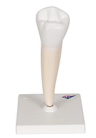 Модель нижнего однокоренного премоляра, 2 части