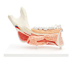 Усовершенствованная модель половины нижней челюсти с 8 больными зубами, 19 частей
