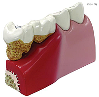 Модель зубов