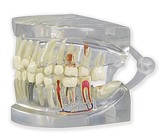 Прозрачная модель челюсти человека с зубами