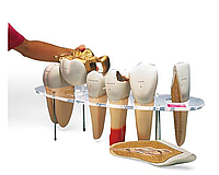 Набор «Морфология зуба», 7 частей, 10-кратное увеличение, на английском языке