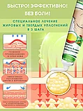 Крем от липомы Sumifun 20 гр., фото 4