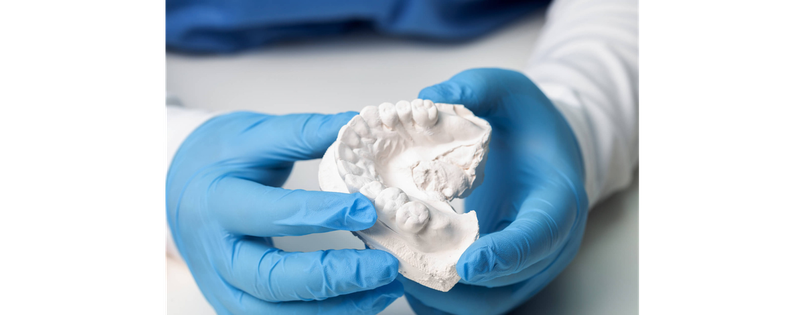 Как выбрать идеальную слепочную массу?