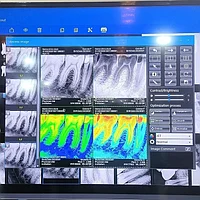 Визиограф Eco-sensor Apple Dental. Радиовизиограф для стоматологии (Китай)