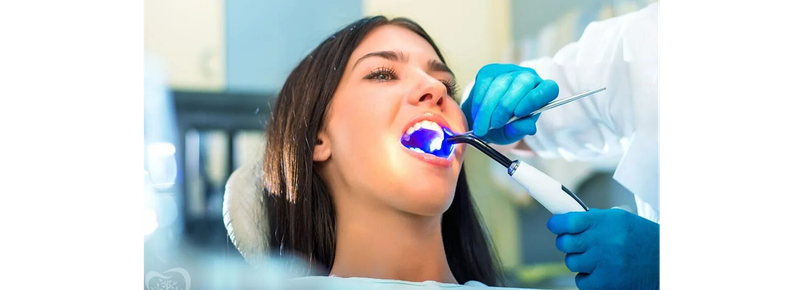 Секреты долговечности пломб из светоотверждаемых материалов