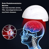 Brain Photobiomodulation Helmet Шлем фотобиомодуляции мозга