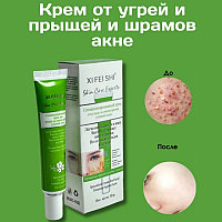 Крем от прыщей и акне XI FEI SHI Skin Care Experts, 35 г