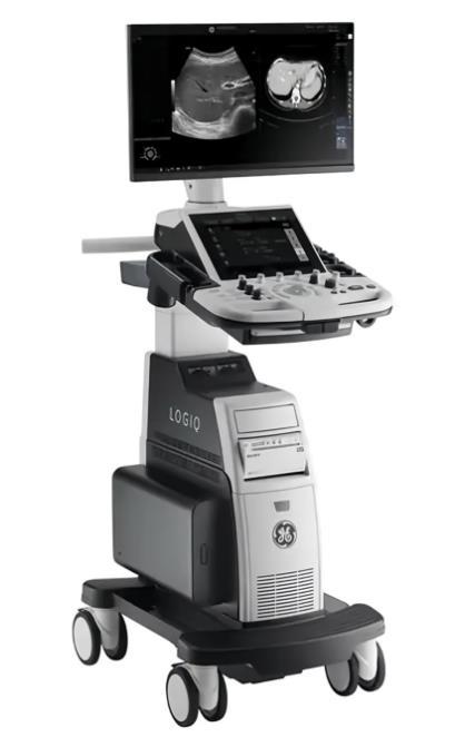 Ультразвуковая система Logiq P8 - фото 1 - id-p126760189