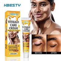 HBESTY Vitiligo Care Cream - Крем для ухода за витилиго 20 гр