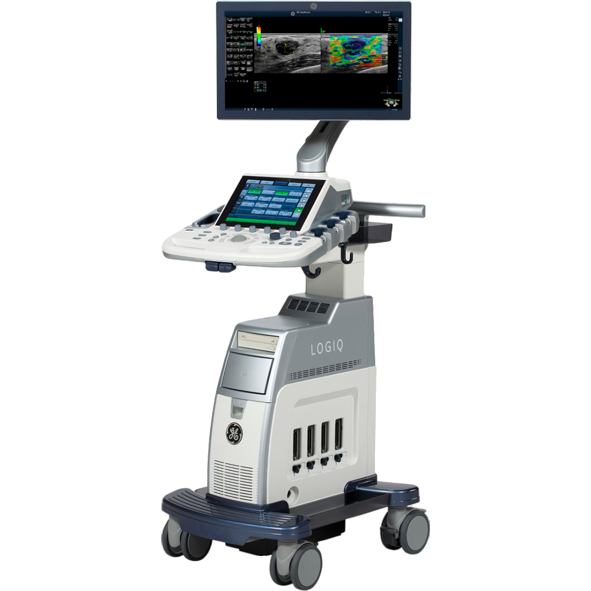 УЗИ аппарат GE Logiq P9 - фото 1 - id-p127241067