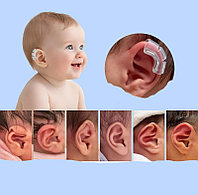 Корректоры ушных раковин у младенца
