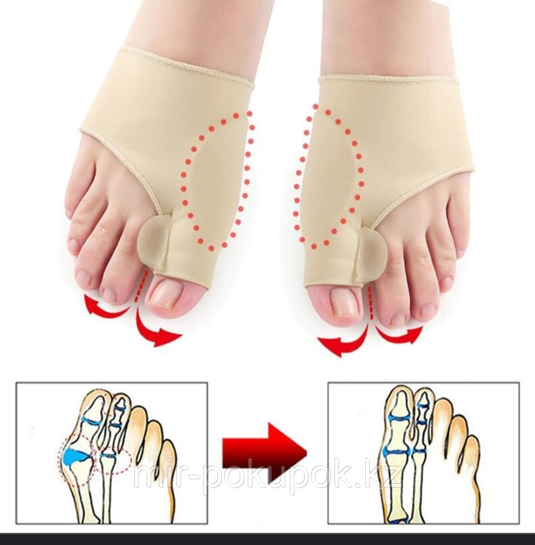 Корректор большого пальца 1 бежевый 2 шт, фото 1