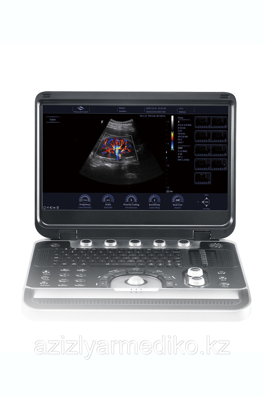 Focus & Fusion Finus 45, фото 1