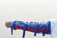 Шины для фиксации переломов AS-05