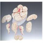 Модель "Мозг человека с артериями "7 частей - фото 1 - id-p22212260