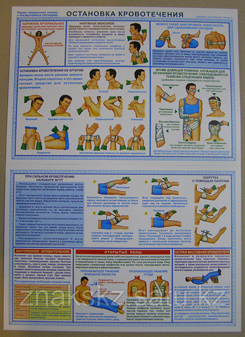 Плакат "Первая медпомощь при чрезвычайных ситуациях" комплект - 6 плакатов - фото 3 - id-p22404644