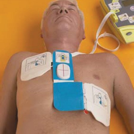 Электроды дефибрилляционные с датчиком контроля качества непрямого массажа сердца CPR-D-Padz - фото 2 - id-p28515984