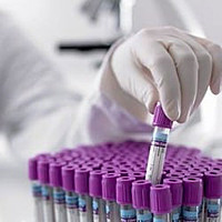 Пробирка вакуумная с сиреневой крышкой с К-3ЭДТА 2 мл: продажа, цена в ...