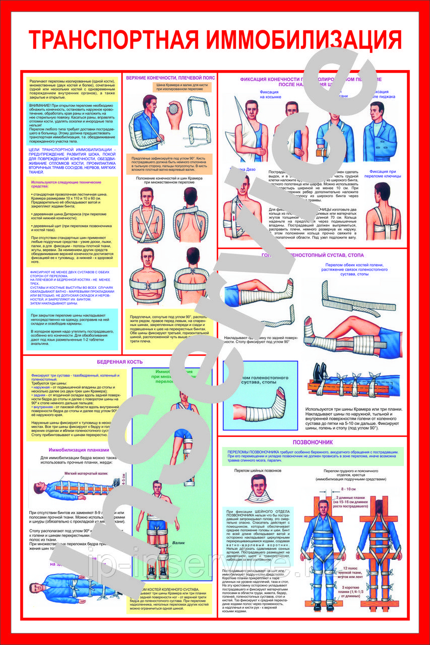 Плакаты Первая медицинская помощь при травмах и переломах - фото 4 - id-p37219538