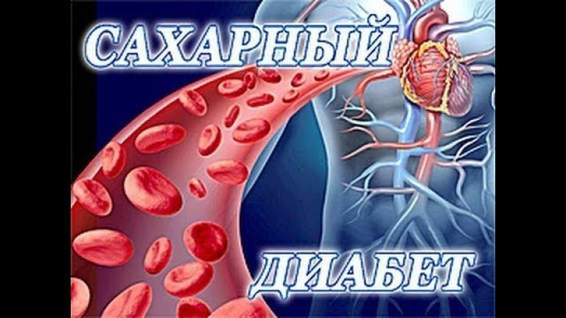 Диабет. Комплекс 2