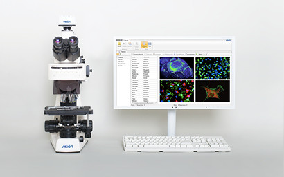 Анализ, подготовка отчетов и организация виртуальных препаратов в флуоресцентной микроскопии Vision Bio® Epi