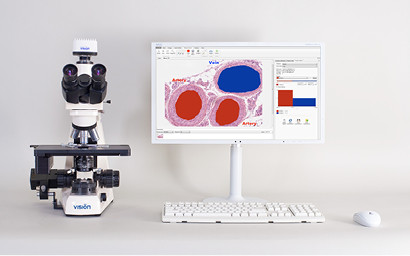 Анализ, подго-ка отчетов и организация виртуальных препаратов в флуоресцентной микроскопии VisionBio®Epi Pro
