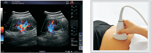 УЗИ Сканер  Zoncare Q9 -  Полностью цифровая допплеровская диагностическая система Премиум класса, фото 3