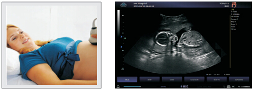 УЗИ Сканер  Zoncare Q9 -  Полностью цифровая допплеровская диагностическая система Премиум класса, фото 2