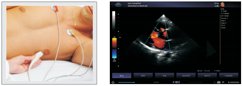 УЗИ Сканер  Zoncare Q9 -  Полностью цифровая допплеровская диагностическая система Премиум класса, фото 3
