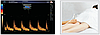 УЗИ Сканер  Zoncare Q9 -  Полностью цифровая допплеровская диагностическая система Премиум класса, фото 2