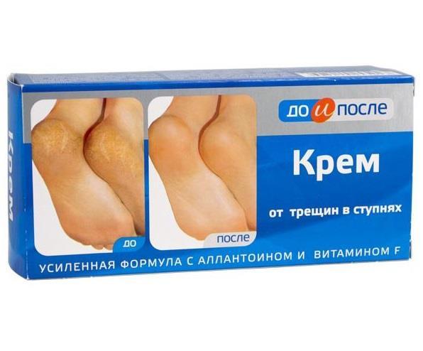 До и После Крем от трещин стоп