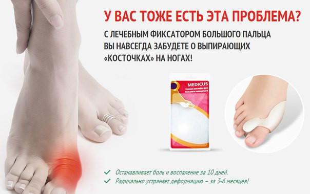 Valgus Pro (Валгус Про) фиксатор – Надежная защита Ваших ног .