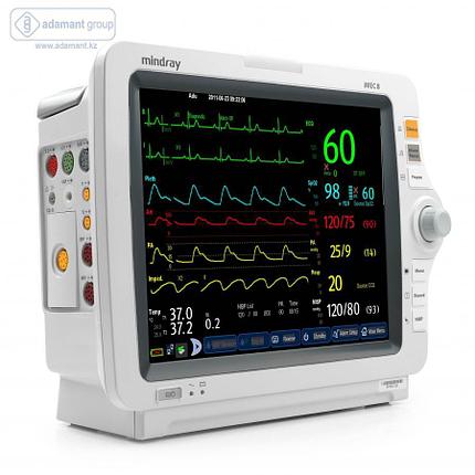 Монитор пациента iMEC 8, фото 2