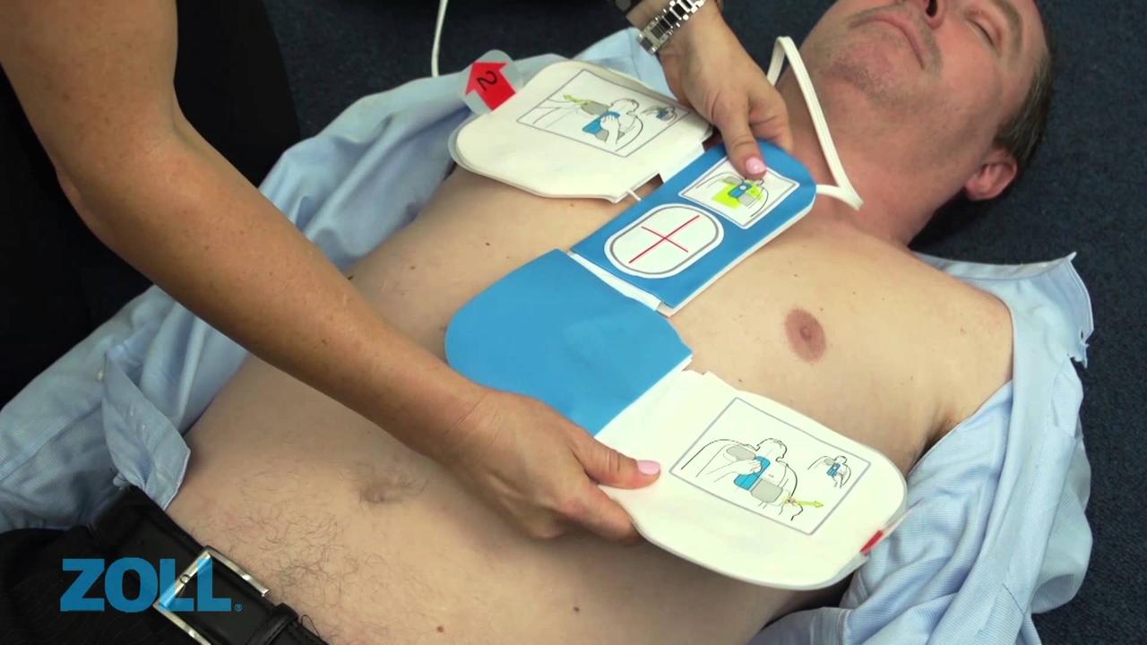 Электроды дефибрилляционные с датчиком контроля качества непрямого массажа сердца CPR-D-Padz - фото 5 - id-p28515984