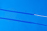 Пелвикс передний цельновязаный сетчатый эндопротез для хирургической реконструкции тазового дна, фото 3