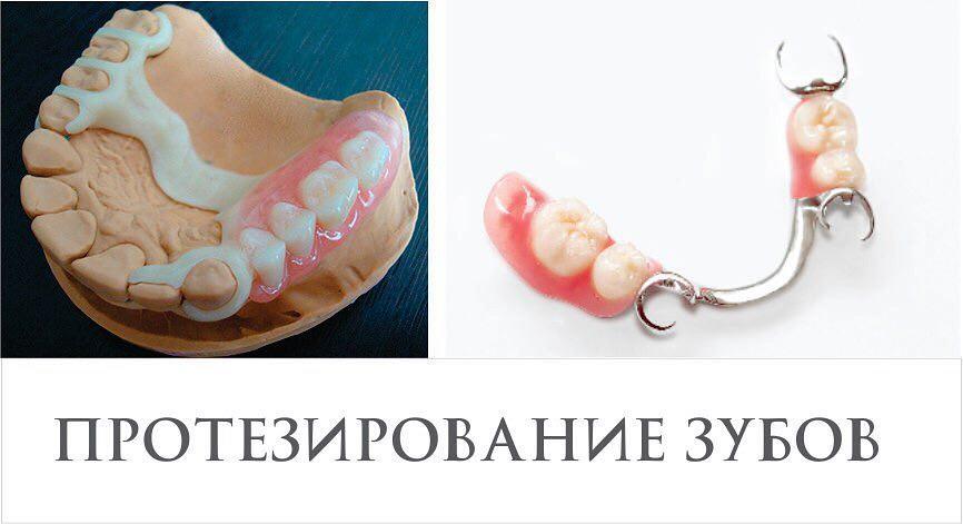 Протезирование зубов - фото 2 - id-p57279406