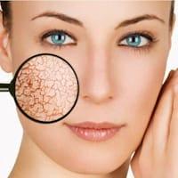 Натуральные препараты для лечения кожных заболеваний