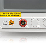 Монитор прикроватный многофункциональный медицинский "Armed" PC-900s (SpO2), фото 8