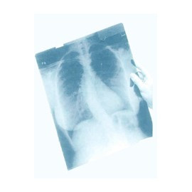 Рентгеновская пленка CARESTREAM MXB (cинечувствительная)