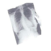 Рентгеновская пленка для общей рентгенологии MXBE (синечувствительная)
